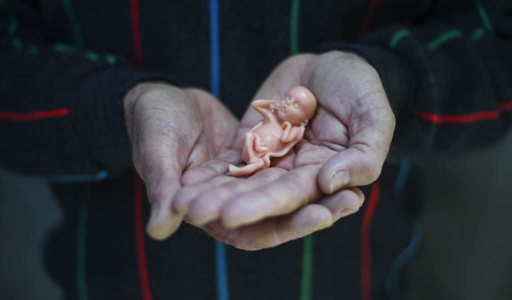 Een model van een foetus van 12 weken oud. Een foetus van een week ouder voelt mogelijk al pijn. (beeld epa / Lukas Koch)