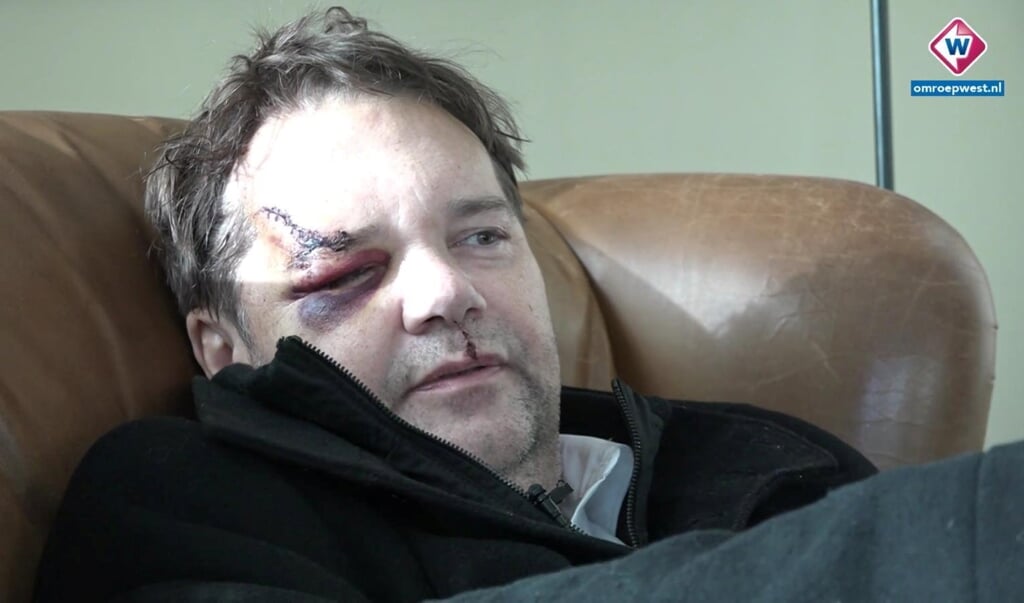 De Katwijker juwelier Daniel Kleen werd overvallen en liep daarbij fikse hoofdwonden op. (beeld omroep west)
