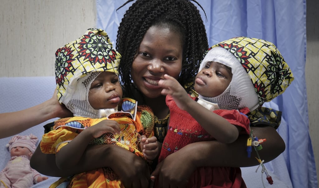 De tweeling Ervina en Prefina met hun moeder nadat hun achterhoofden en bloedvatensystemen in het Vaticaanse kinderziekenhuis Bambino Gesù van elkaar gescheiden waren. (beeld afp / bambino gesu hospital)