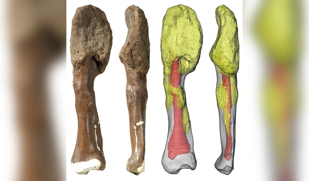 Kuitbeen van een dinosaurus met botkanker. Door de kanker is de bovenkant van het bot vervormd. (beeld Danielle Dufault en Royal Ontario Museum / McMasterUniversity)