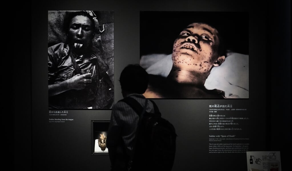 Een bezoeker van het Hiroshima Peace Memorial Museum bekijkt foto's van Japanse soldaten, die gewond zijn geraakt door de atoombommen op Hiroshima en Nagasaki, deze week 75 jaar geleden. (beeld epa / Dai Kurokawa)