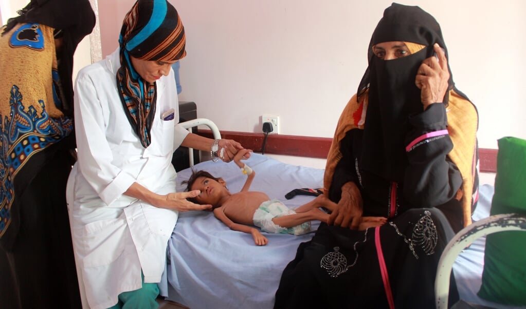 Eén op de vijf kinderen in Jemen is ondervoed, blijkt uit de cijfers van de Verenigde Naties. (beeld afp / Essa Ahmed)