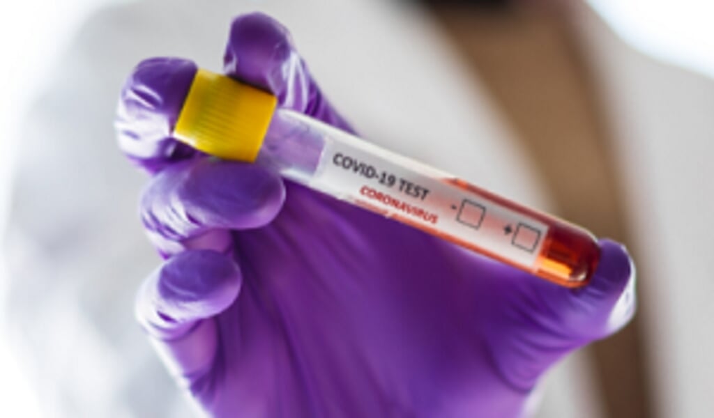 De sneltest is gemakkelijker uit te voeren en geeft veel sneller de uitslag dan de PCR-test. (beeld universiteit van birmingham)